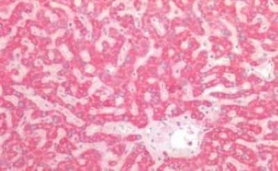 Immunohistochemistry-Paraffin: GNAQ Antibody [NBP3-14563]